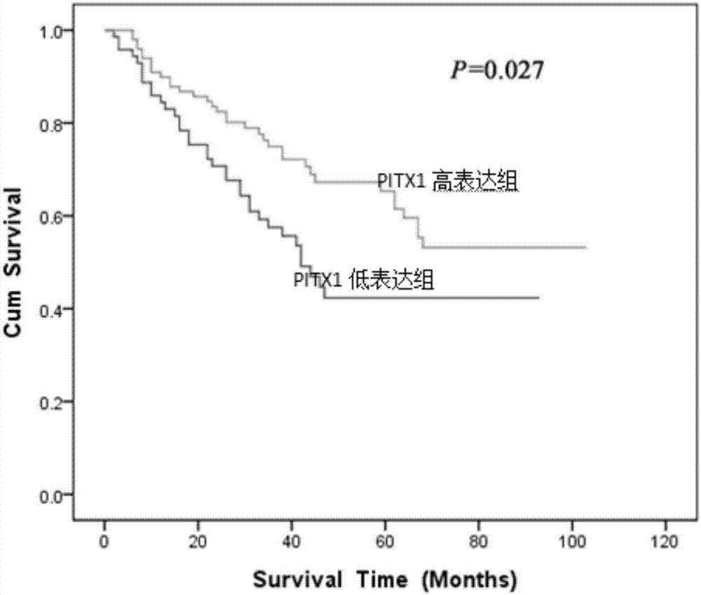 Application of reagent for detecting PITX1 (paired-like homeodomain 1) expression in preparation of gastric cancer prognosis evaluation kit