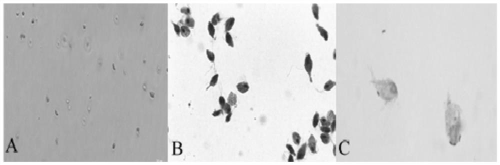 Application for inhibiting activity of trichomonas gallinae in vitro by using bile acid