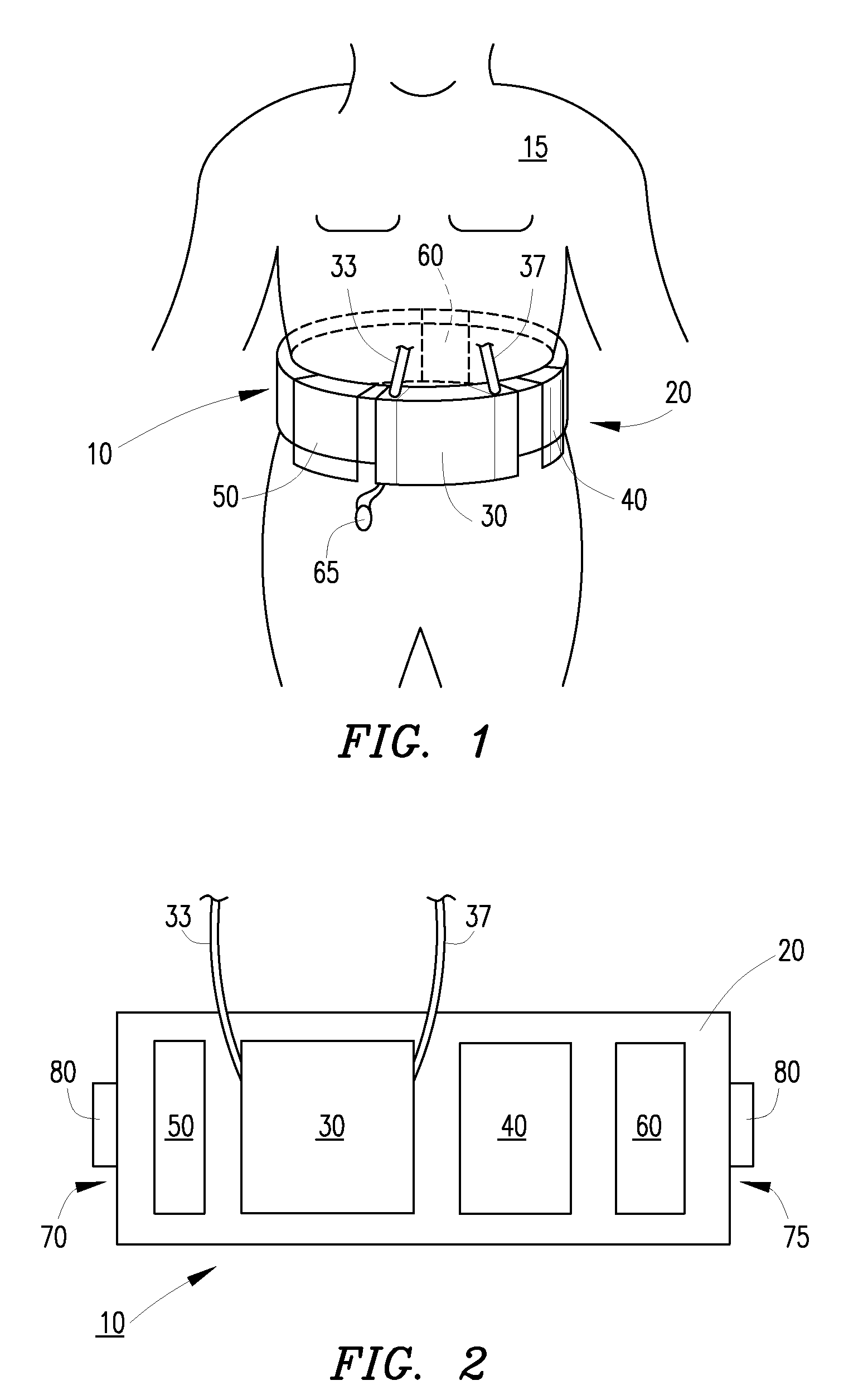 Dual-ventricle pump cartridge, pump and method of use in a wearable continuous renal replacement therapy device