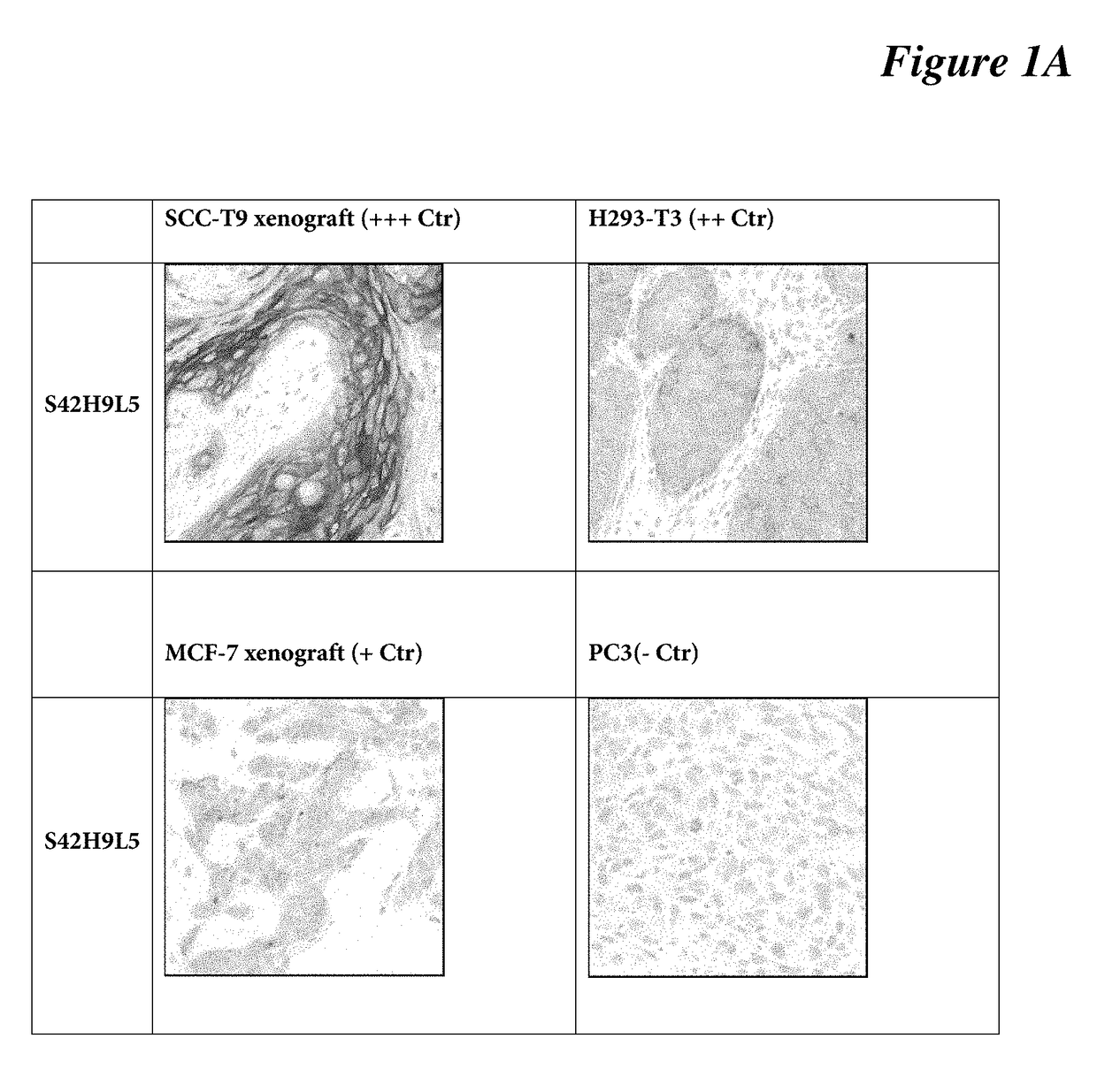 Antibodies, compositions, and immunohistochemistry methods for detecting c4.4a