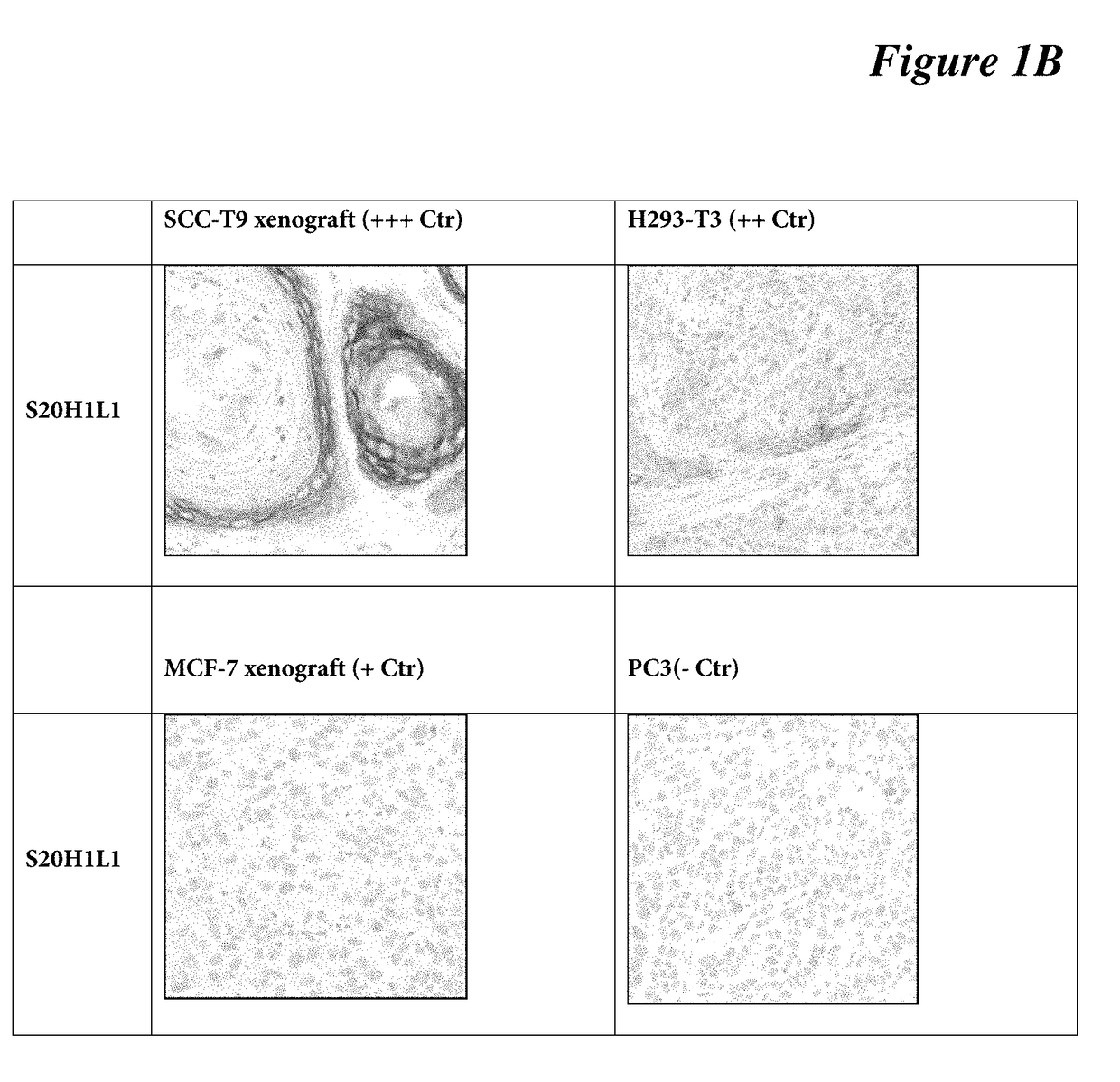 Antibodies, compositions, and immunohistochemistry methods for detecting c4.4a