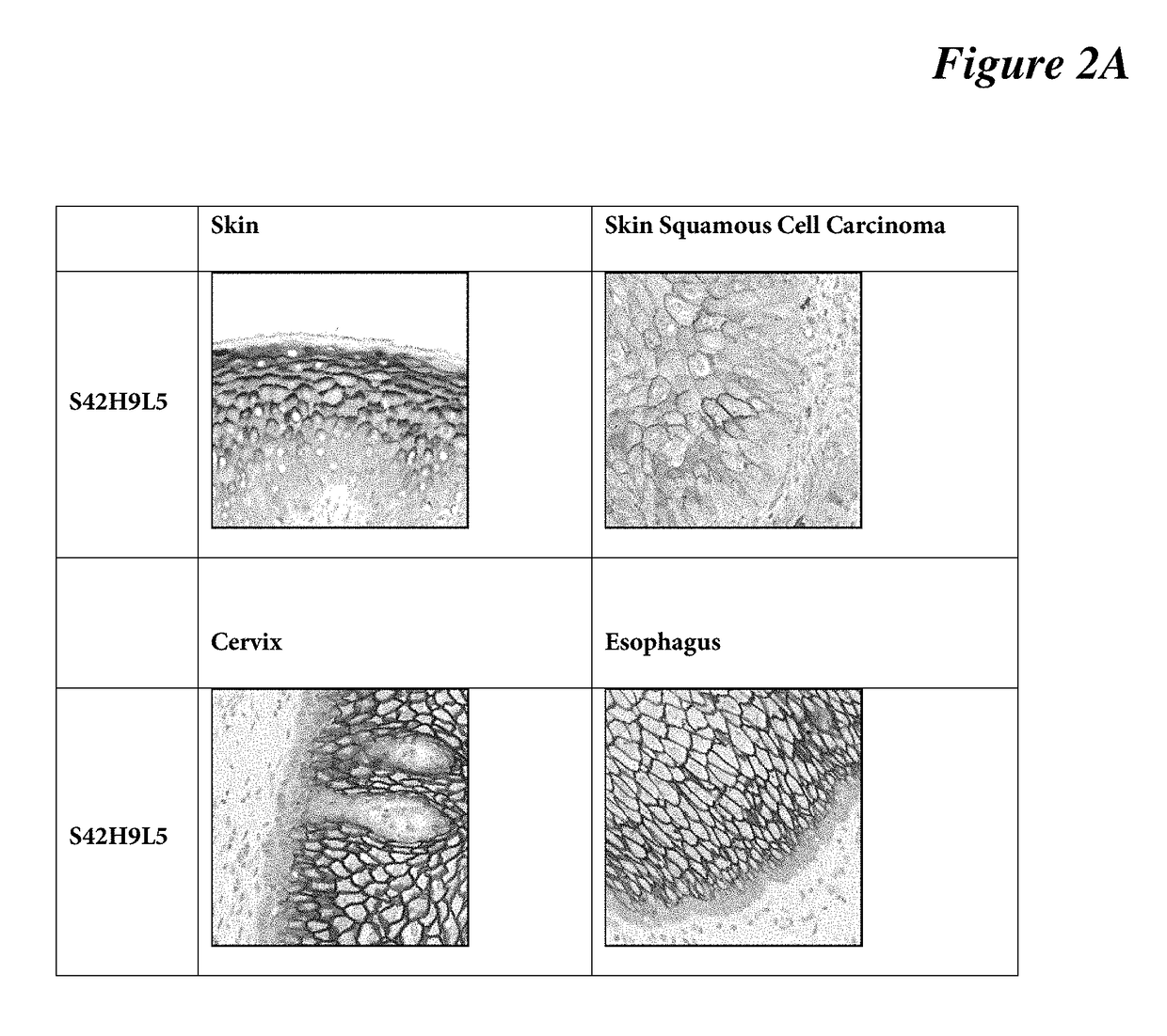 Antibodies, compositions, and immunohistochemistry methods for detecting c4.4a