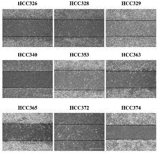 Methods and compositions for treating C-MET associated cancers