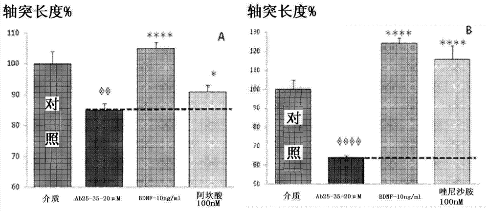 Combination compositions for the treatment of Alzheimer's disease and related disorders using zonisamide and acamprosate