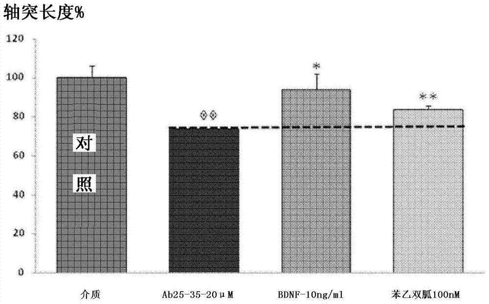 Combination compositions for the treatment of Alzheimer's disease and related disorders using zonisamide and acamprosate