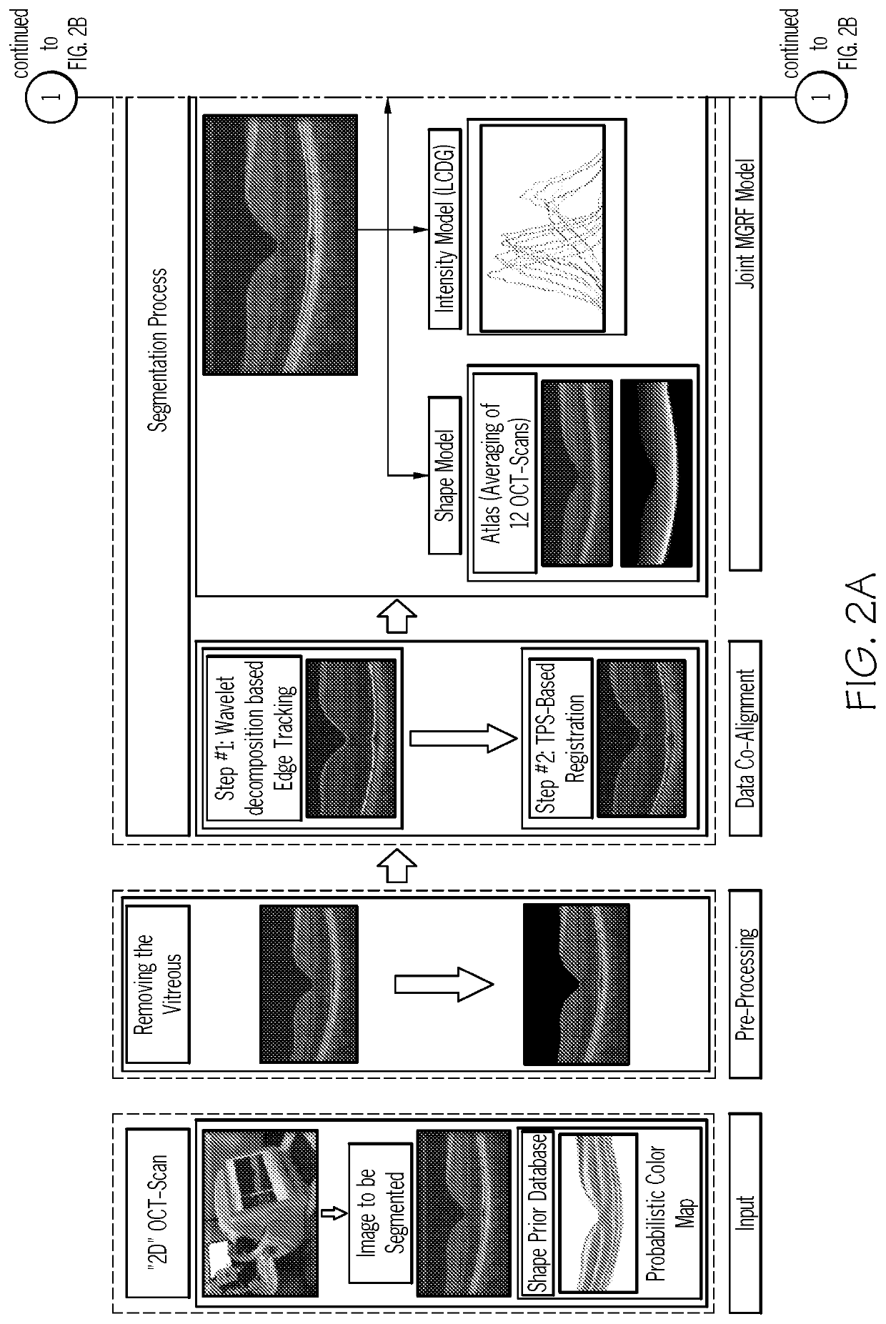 Automated methods for the objective quantification of retinal characteristics by retinal region and diagnosis of retinal pathology