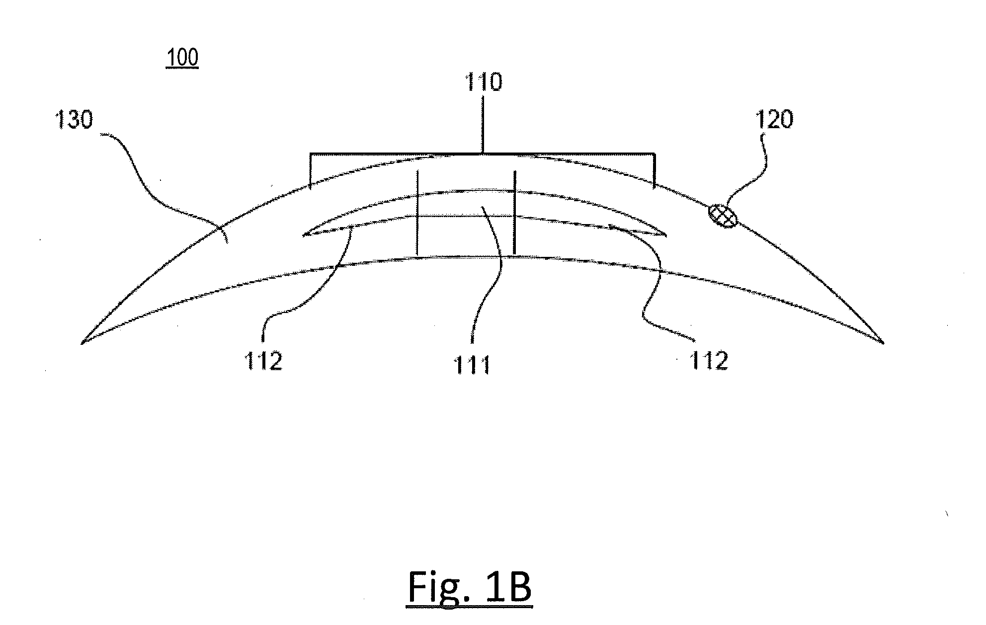 Method of manufacturing hydrogel ophthalmic devices with electronic elements