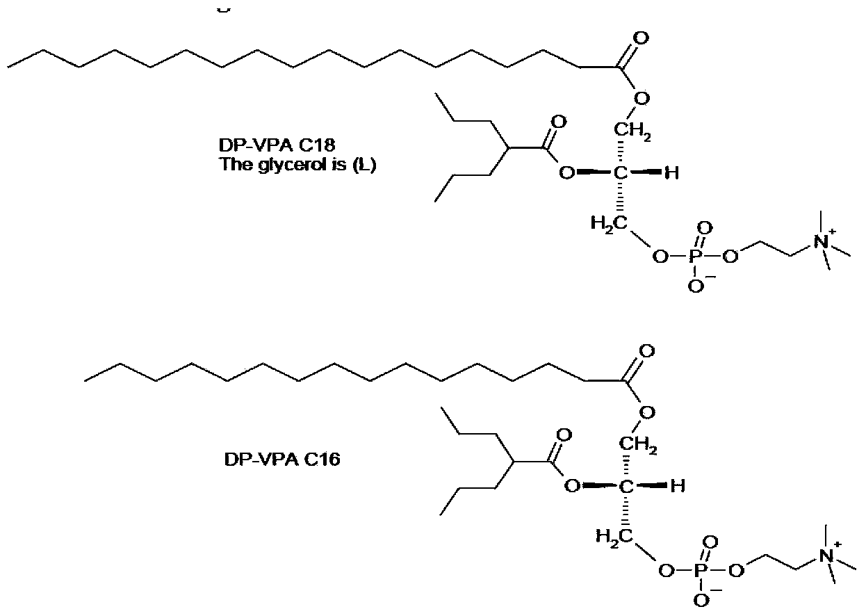 Preparation method of valproic acid phospholipid derivative