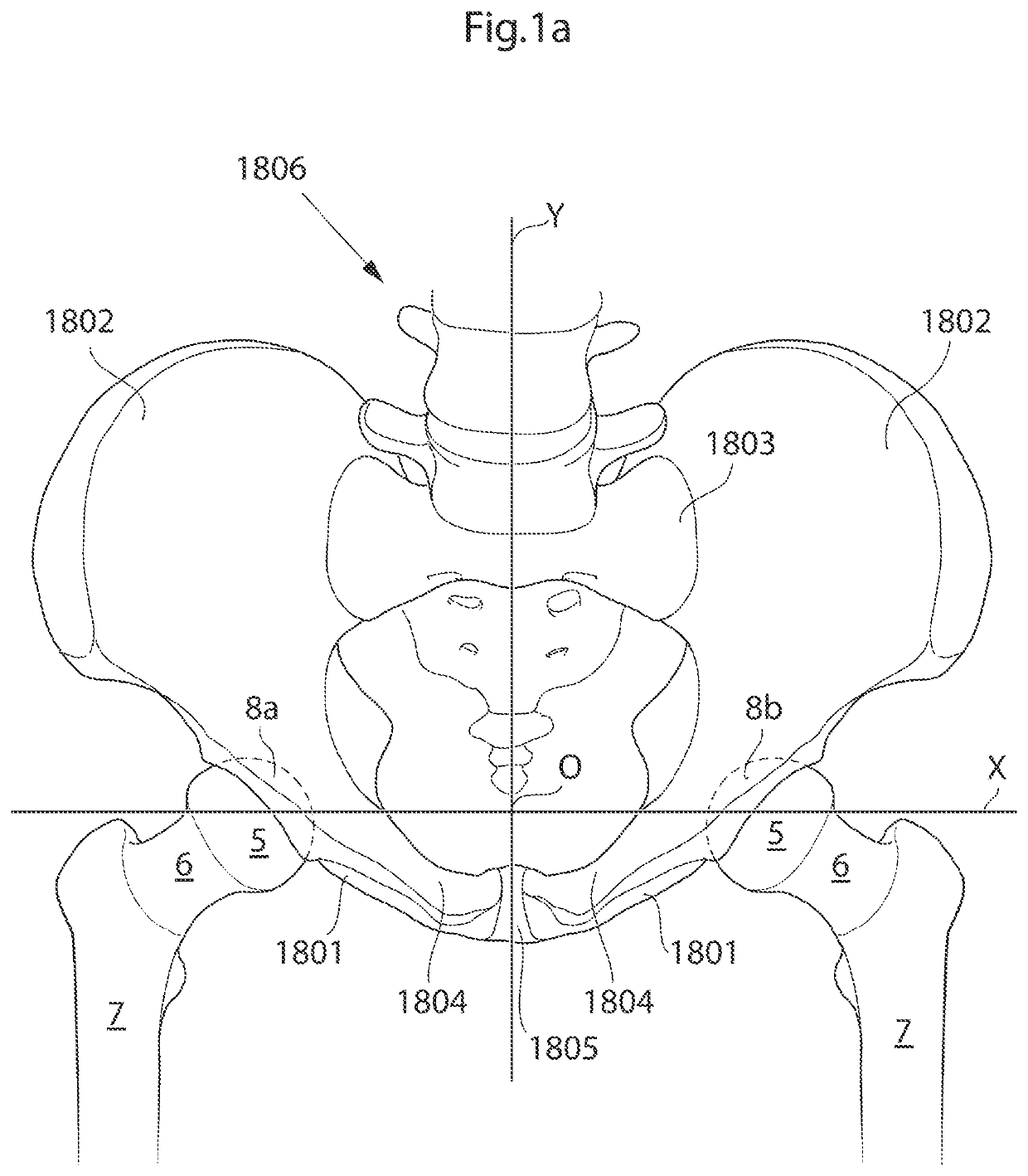 Hip joint device