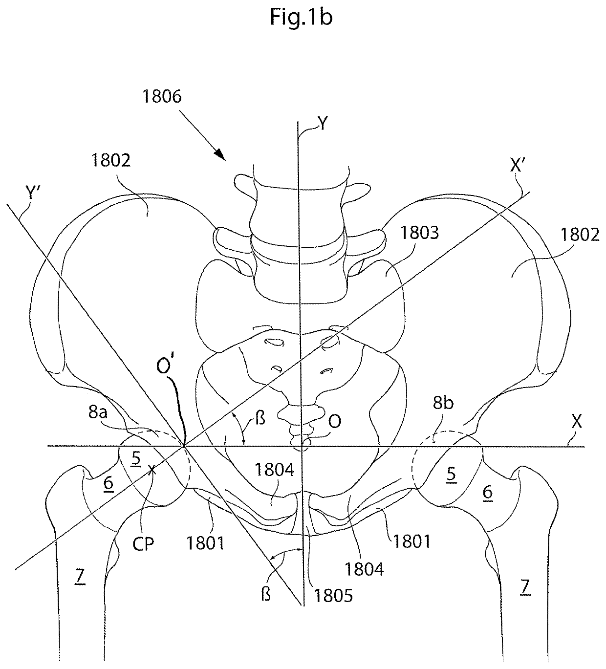 Hip joint device