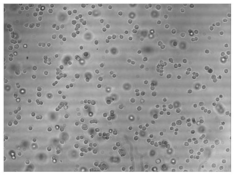 A method for preparing mink parvovirus enteritis antigen protein complex, antigen protein complex and application thereof