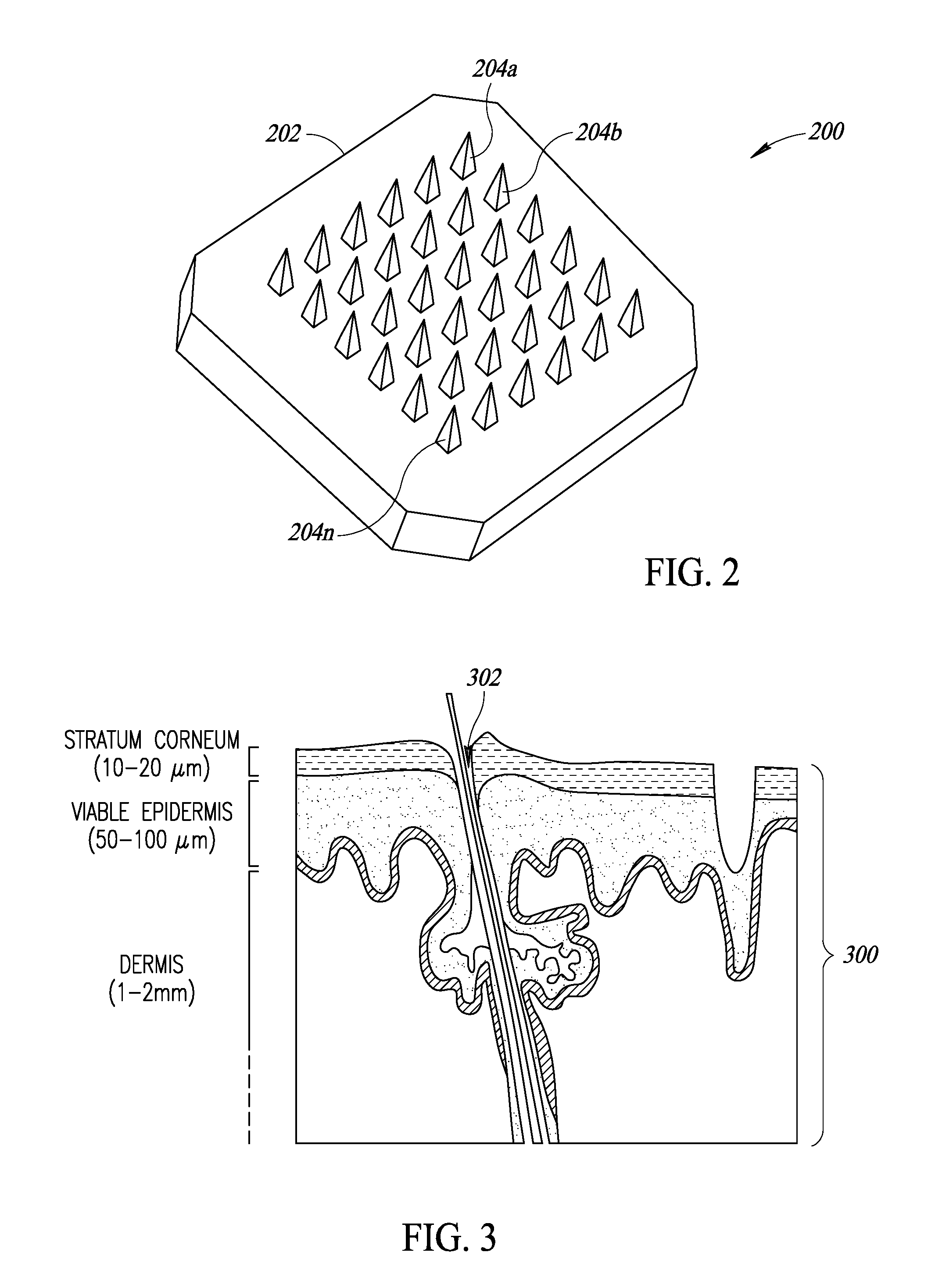 Device and method of skin care and treatment via microneedles having inherent anode and cathode properties, with or without cosmetic or pharmacological compositions