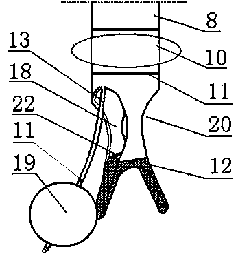 One-lung ventilation integrated device of single-cavity trachea catheter and bronchus blocking device