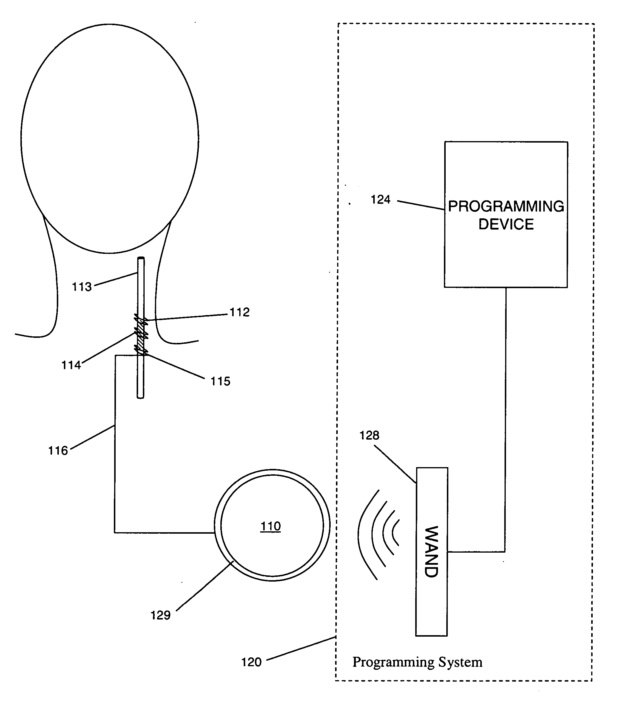 Compensation reduction in tissue stimulation therapy