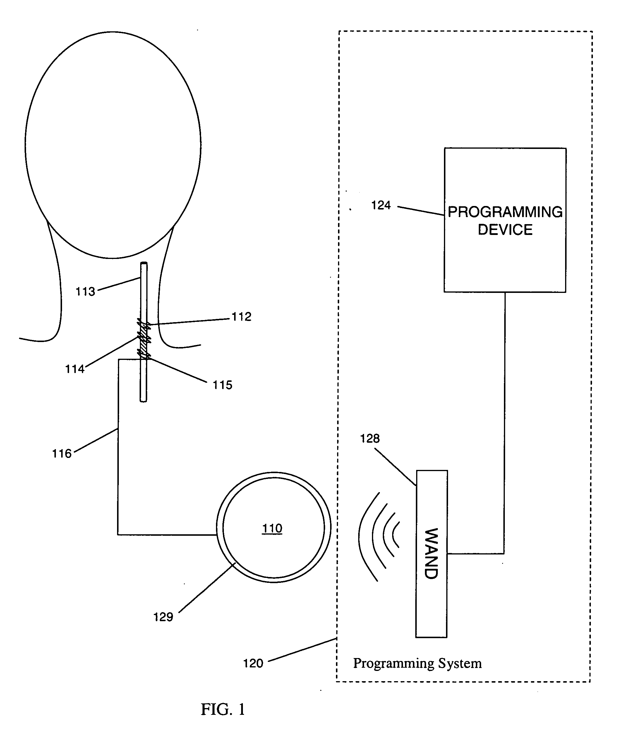 Compensation reduction in tissue stimulation therapy