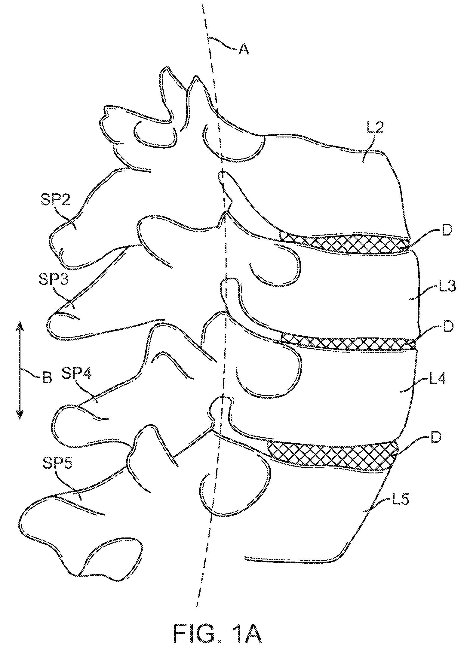 Methods and apparatus for locking a band