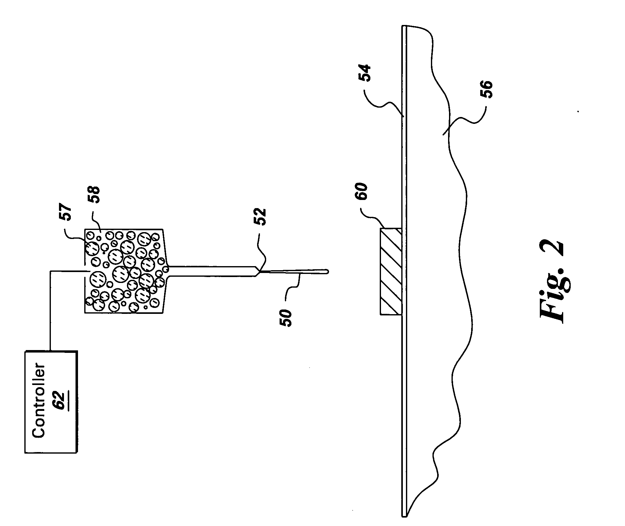 Method of forming concavities in the surface of a metal component, and related processes and articles