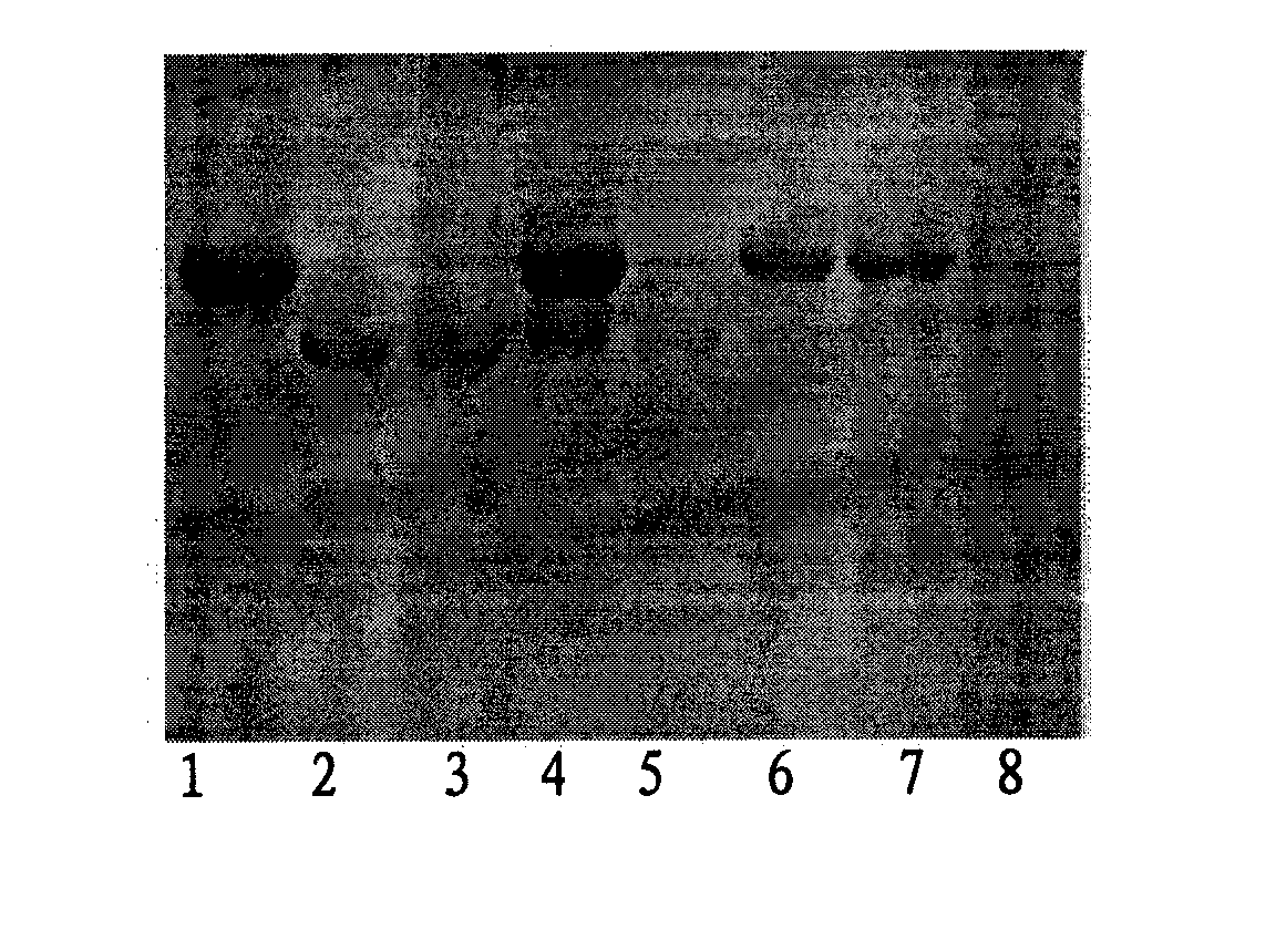 Preparation method of immunomagnetic microparticle