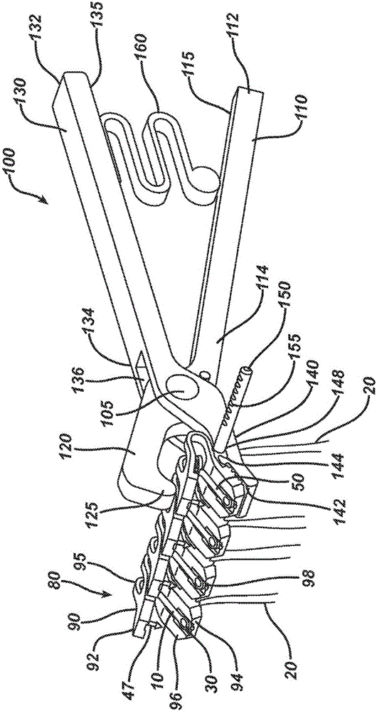 Method and means to attach anchor sutures onto mesh implants