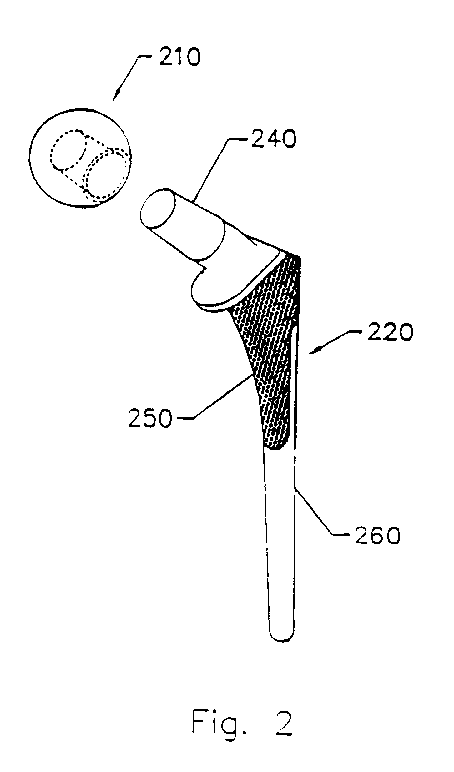 Implant with composite coating