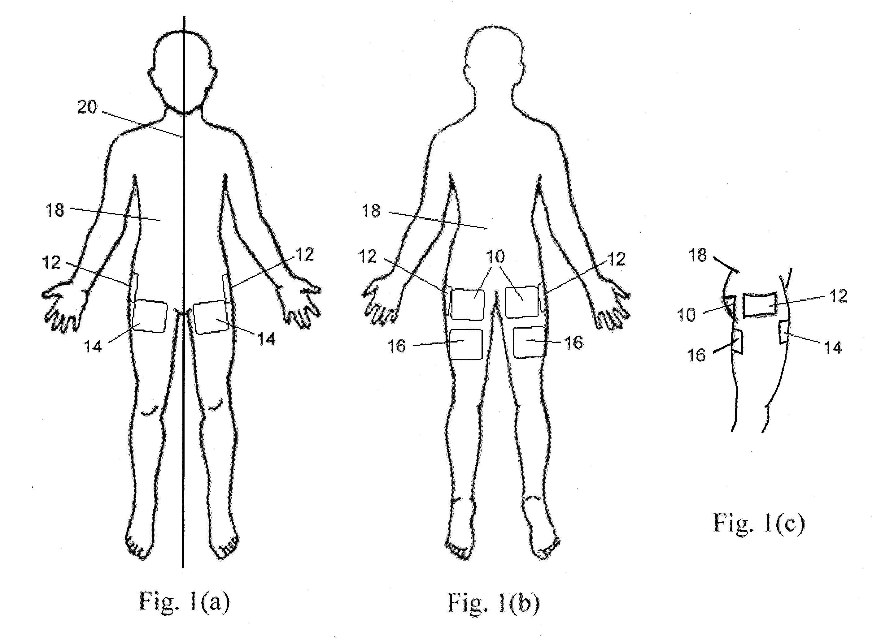 Method and apparatus for stimulating pelvic floor muscles