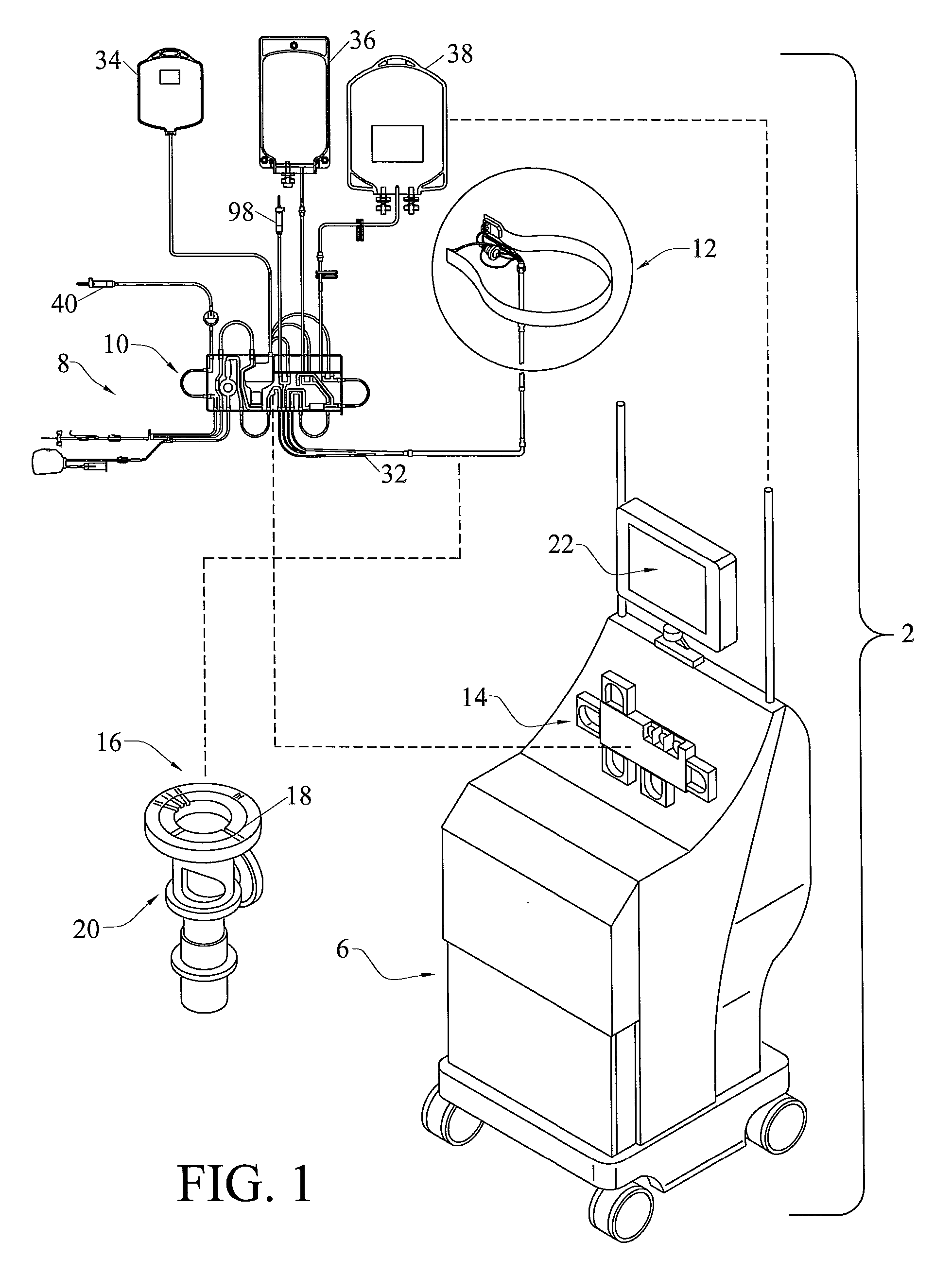 System for Blood Separation with Gravity Valve for Controlling a Side-Tapped Separation Chamber