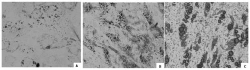 Mesenchymal stem cell adipogenesis induced differentiation method