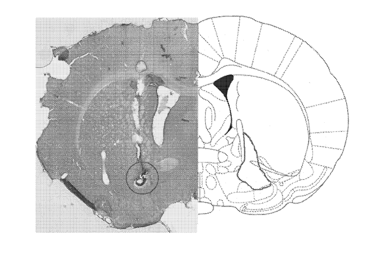 Stimulation of the ventral pallidum for the treatment of epilepsy