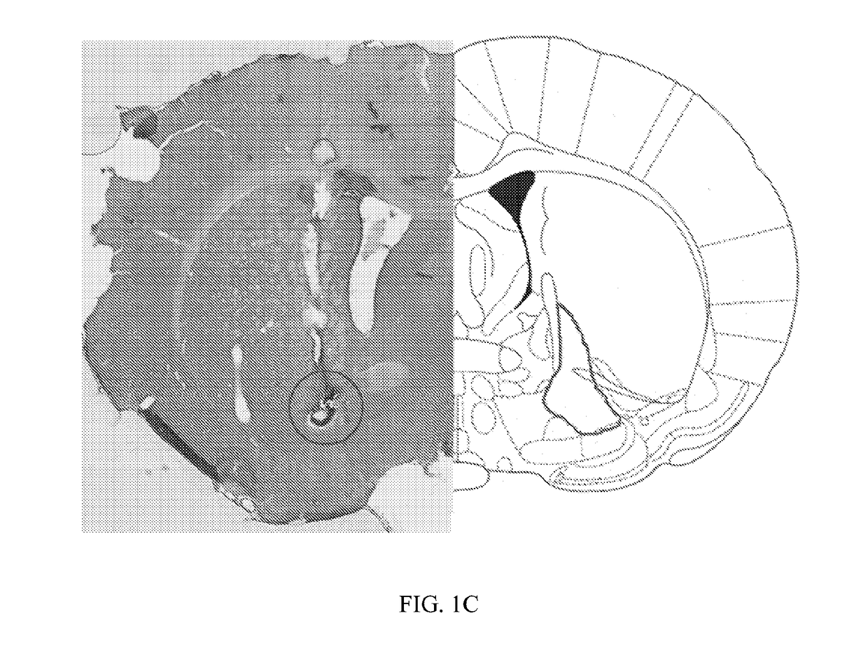 Stimulation of the ventral pallidum for the treatment of epilepsy