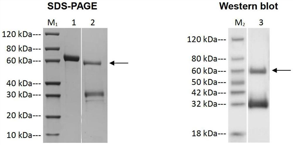 An anti-angptl3 monoclonal antibody and its use in the preparation of a medicine for treating nephrotic syndrome