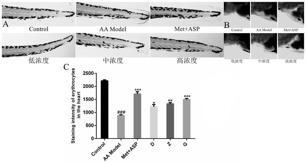 Leonurine, polygonatum polysaccharide and deoxynojirimycin pharmaceutical composition and application thereof