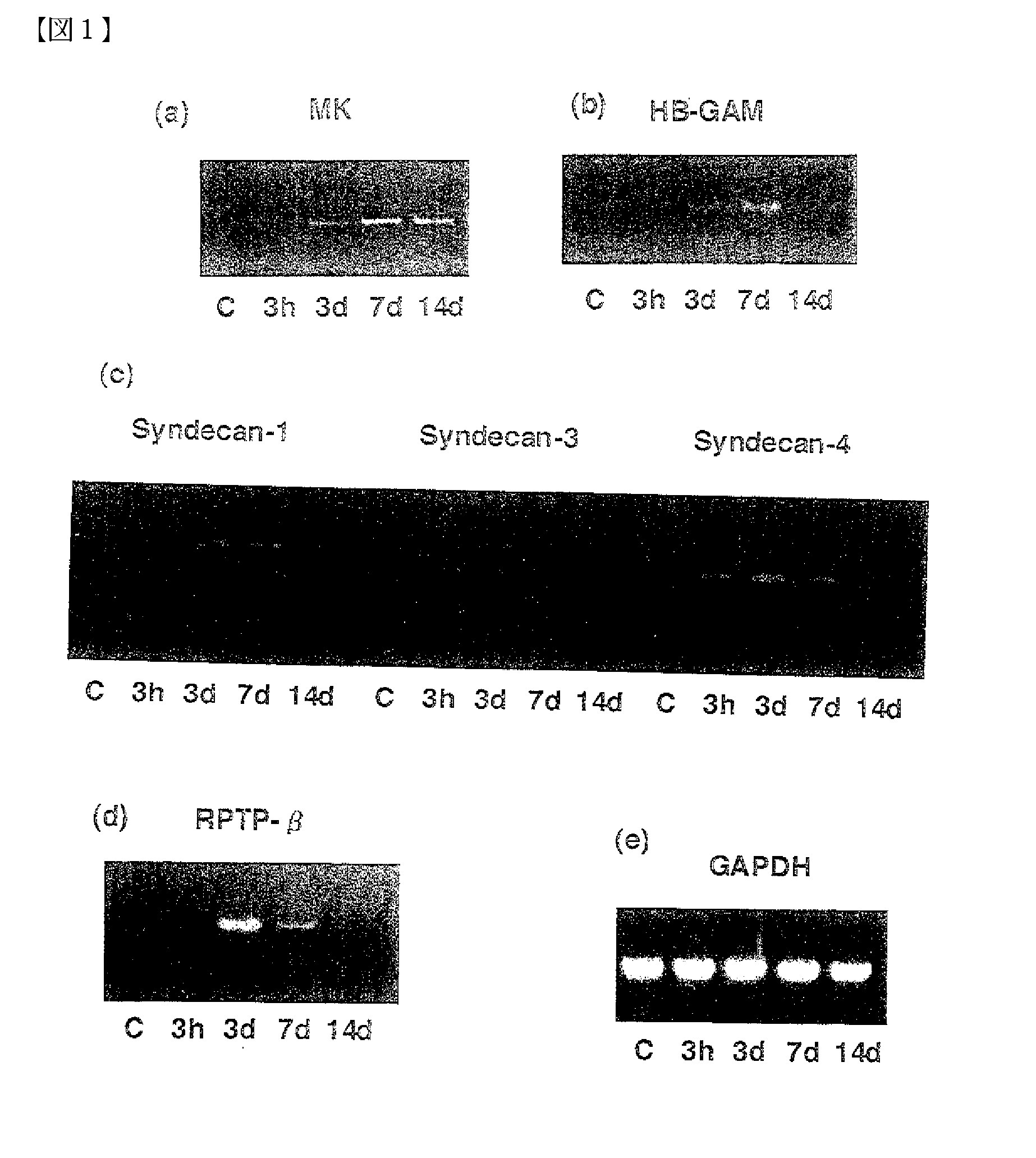 Pharmaceutical Compositions for the Prevention and Treatment of Atherosclerosis and Restenosis After PTCA