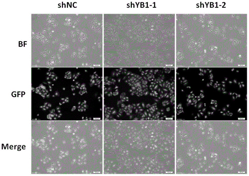shRNA (short hairpin ribonucleic acid) targeted interfering YB-1 gene human lung adenocarcinoma a549 cell strains capable of stably expressing GFP (green fluorescent protein)