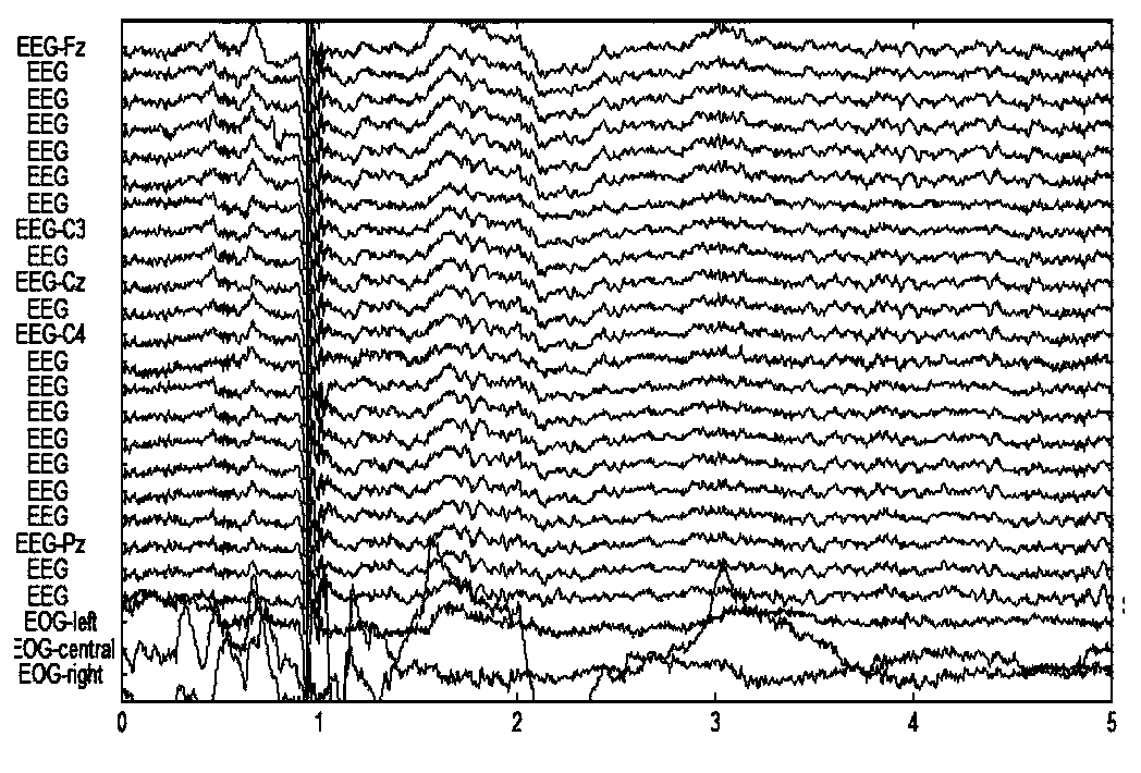 electroencephalogram signal classification method based on a Gaussian Bernoulli convolution deep belief network