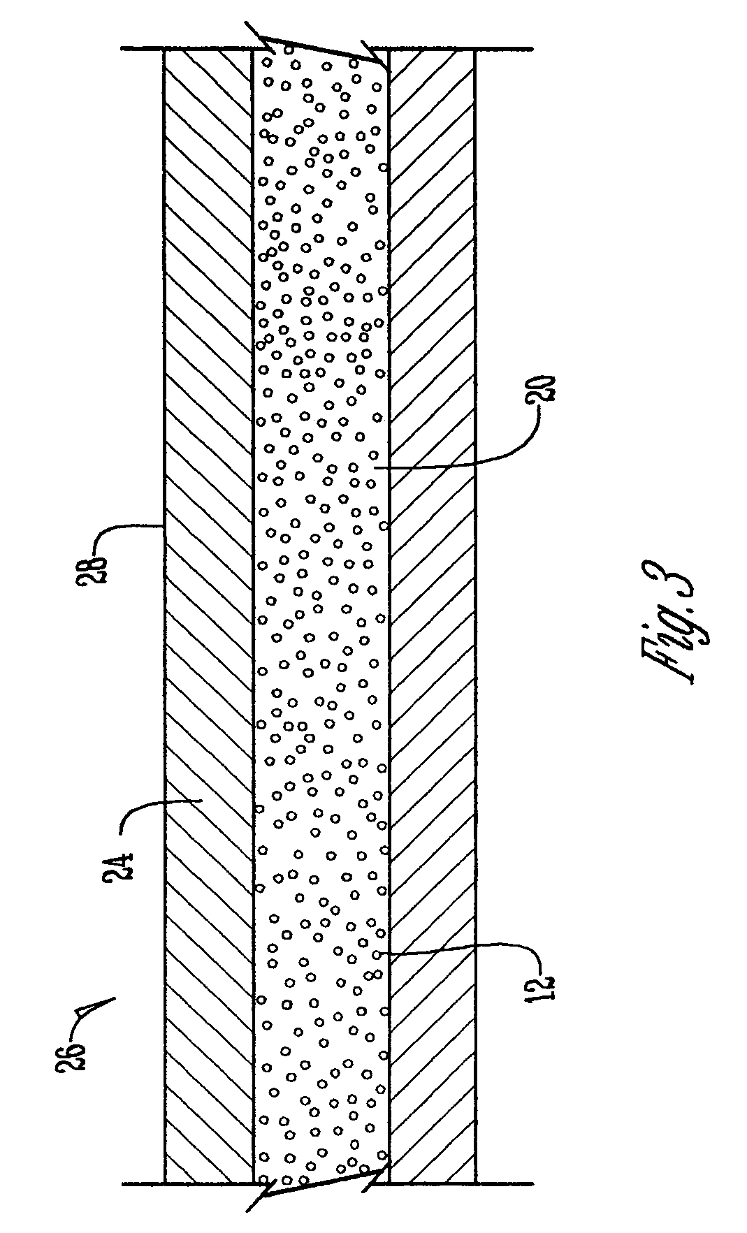 Layered nuclear-cored battery