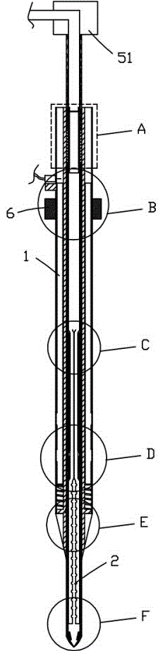 Comprehensive ruminal tympany treatment device