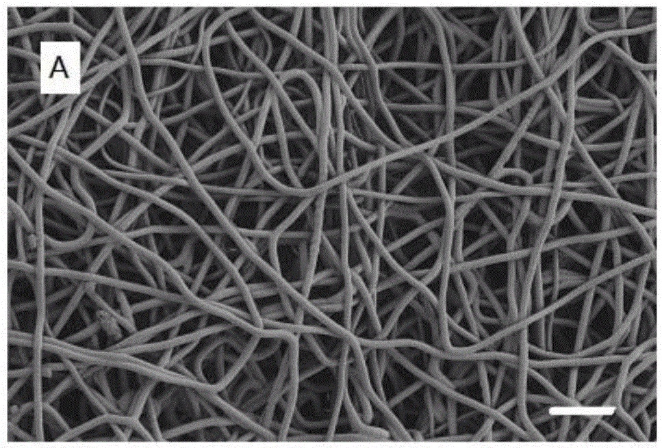 Shape memory type high-elasticity activity nano-fiber stent and application thereof