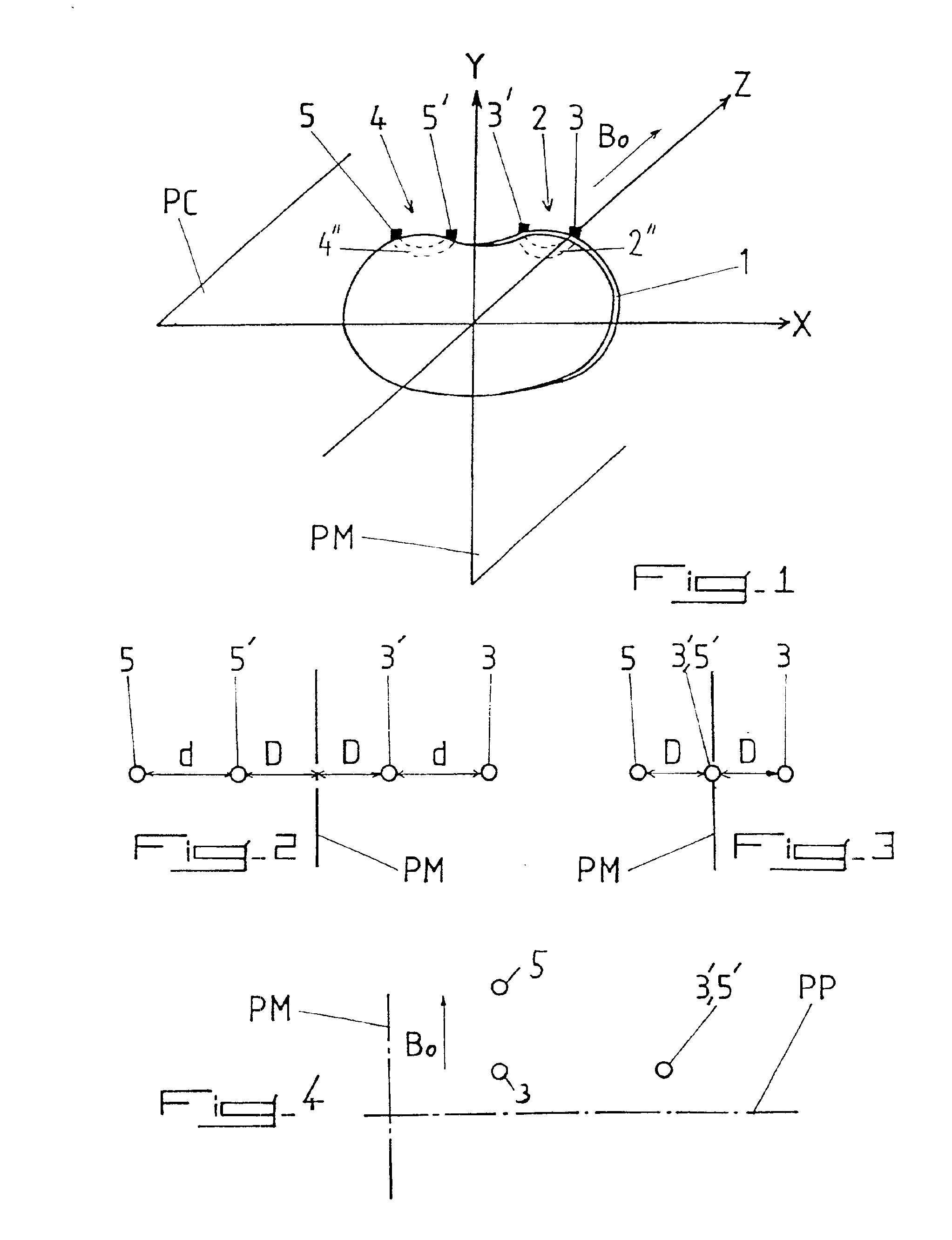 Method and apparatus for obtaining an electrocardiograph
