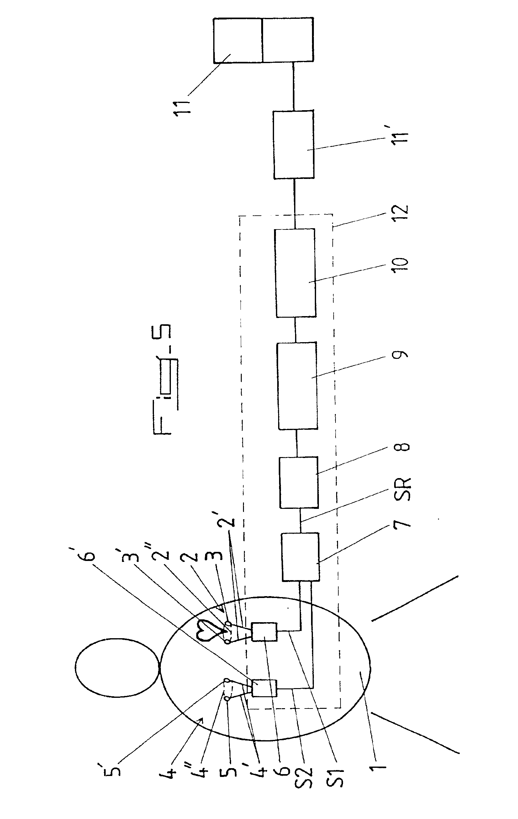 Method and apparatus for obtaining an electrocardiograph