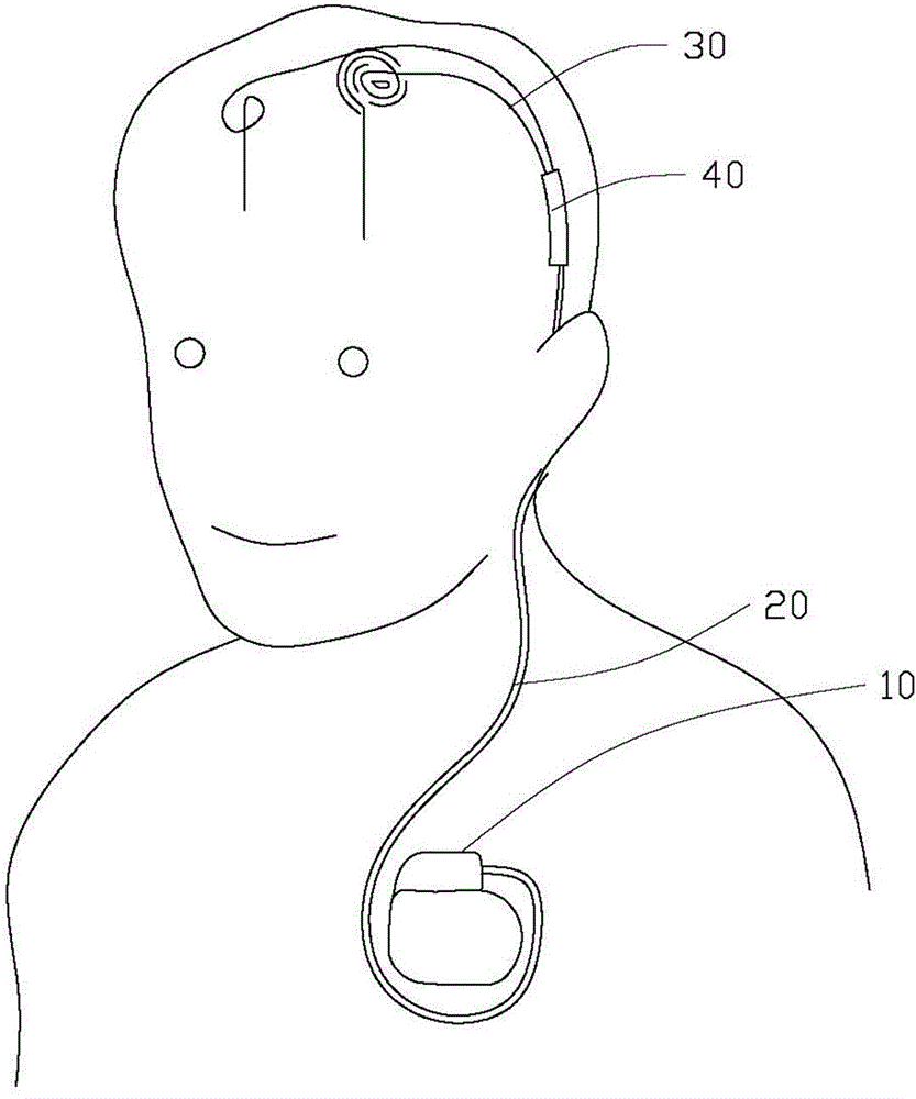 Implanted type electrical nerve stimulation system and protection sleeve applied to same