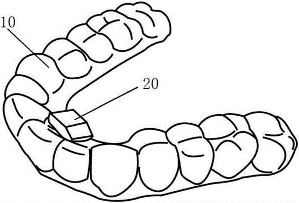 Multifunctional intelligent invisible orthodontic braces and making method thereof
