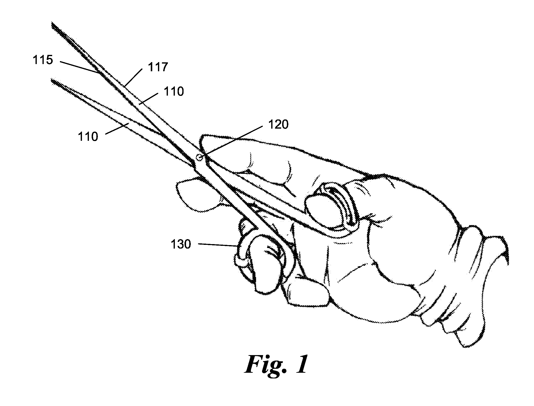 Scissor Handle Opening Sizer