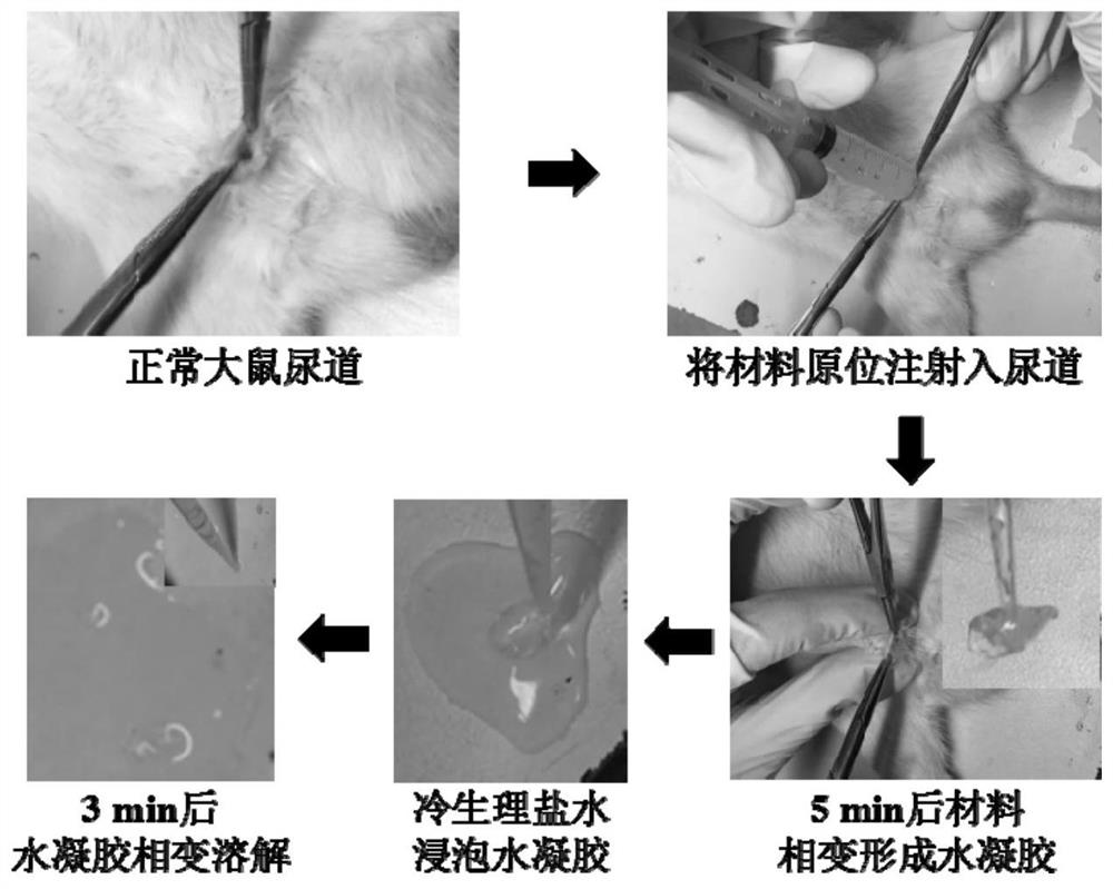 A method of forming a temporary obstruction of the urethra