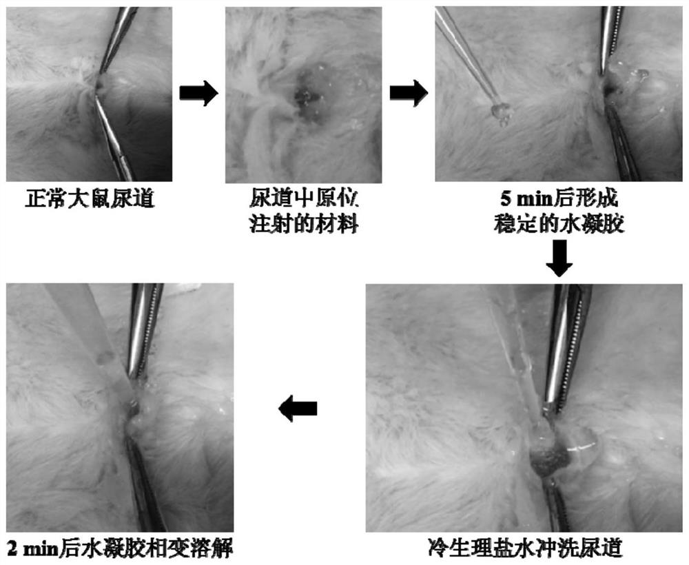 A method of forming a temporary obstruction of the urethra