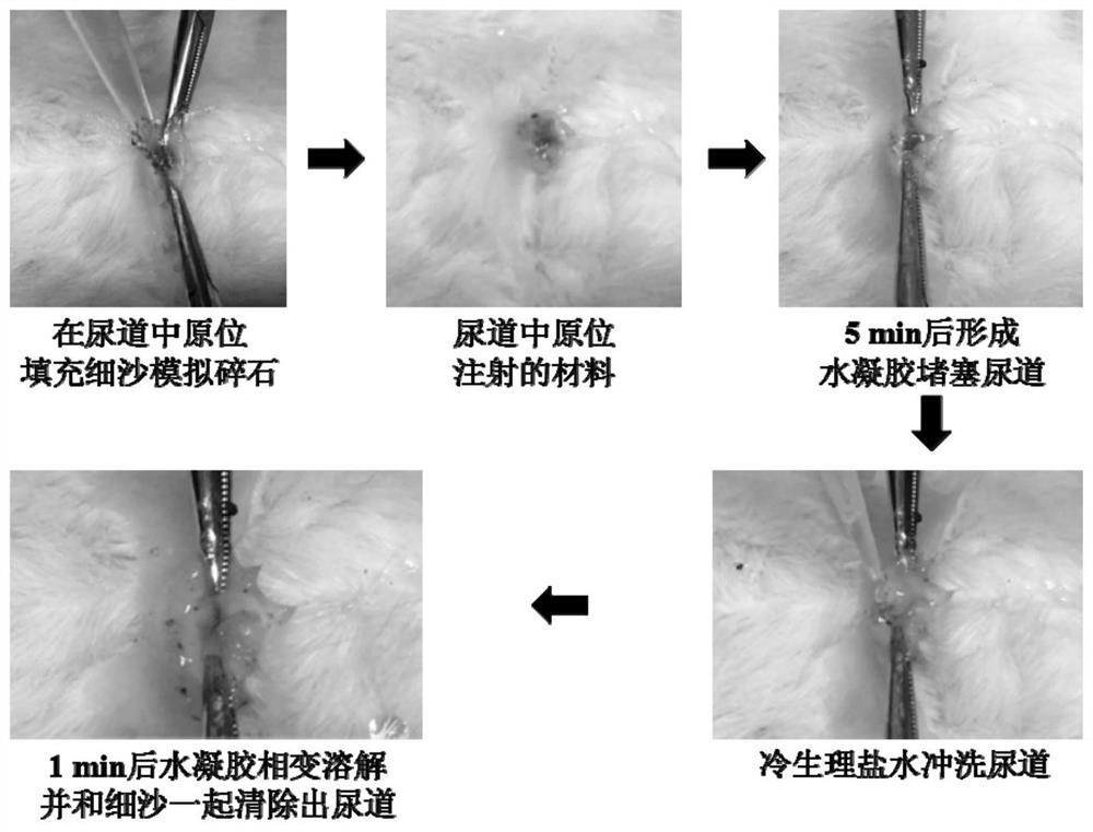 A method of forming a temporary obstruction of the urethra