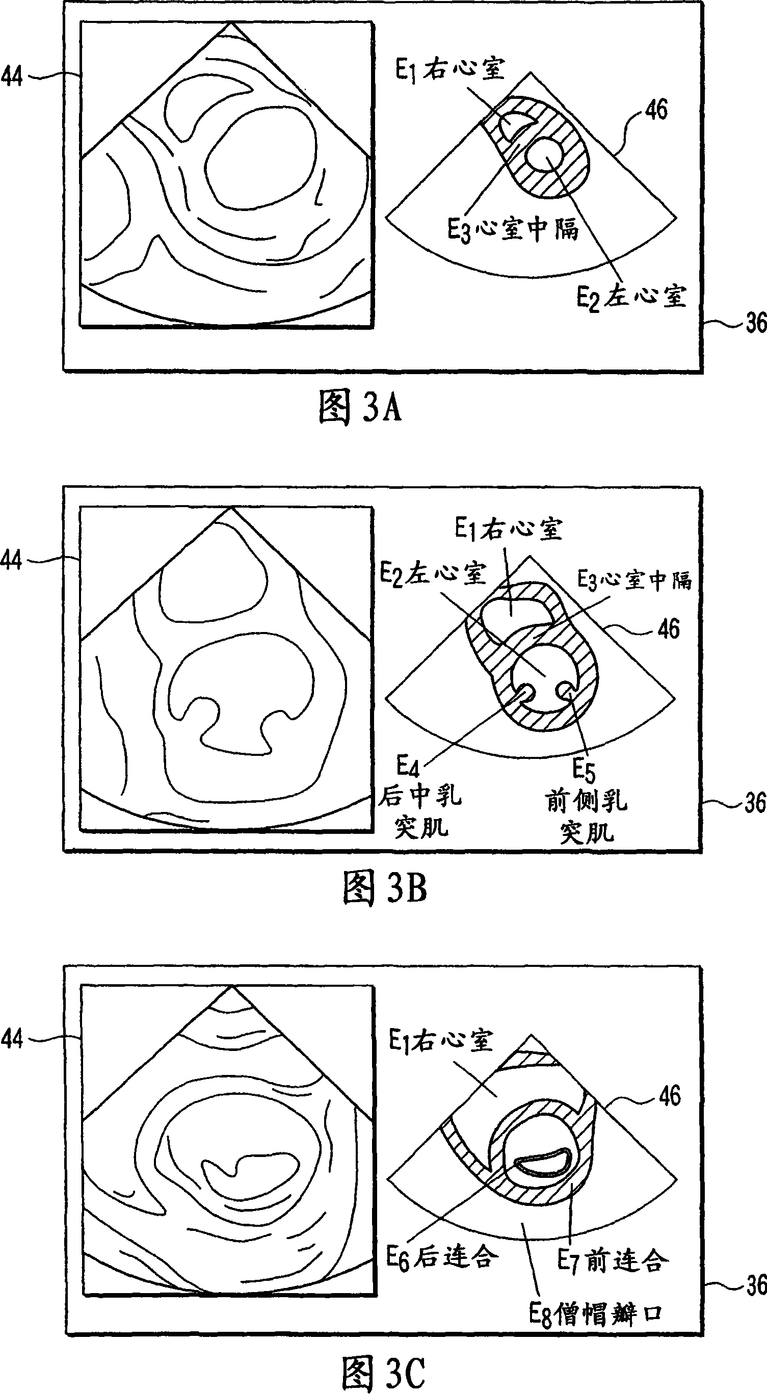Ultrasonic diagnostic apparatus and the diagnostic method thereof