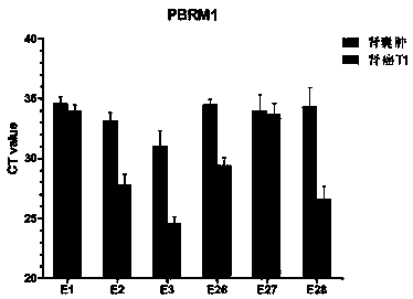 Renal cancer exosome marker group and application thereof