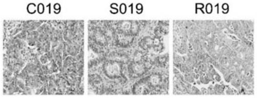 Combination of cdk4/6 inhibitor combined with her2 inhibitor for gastric cancer treatment