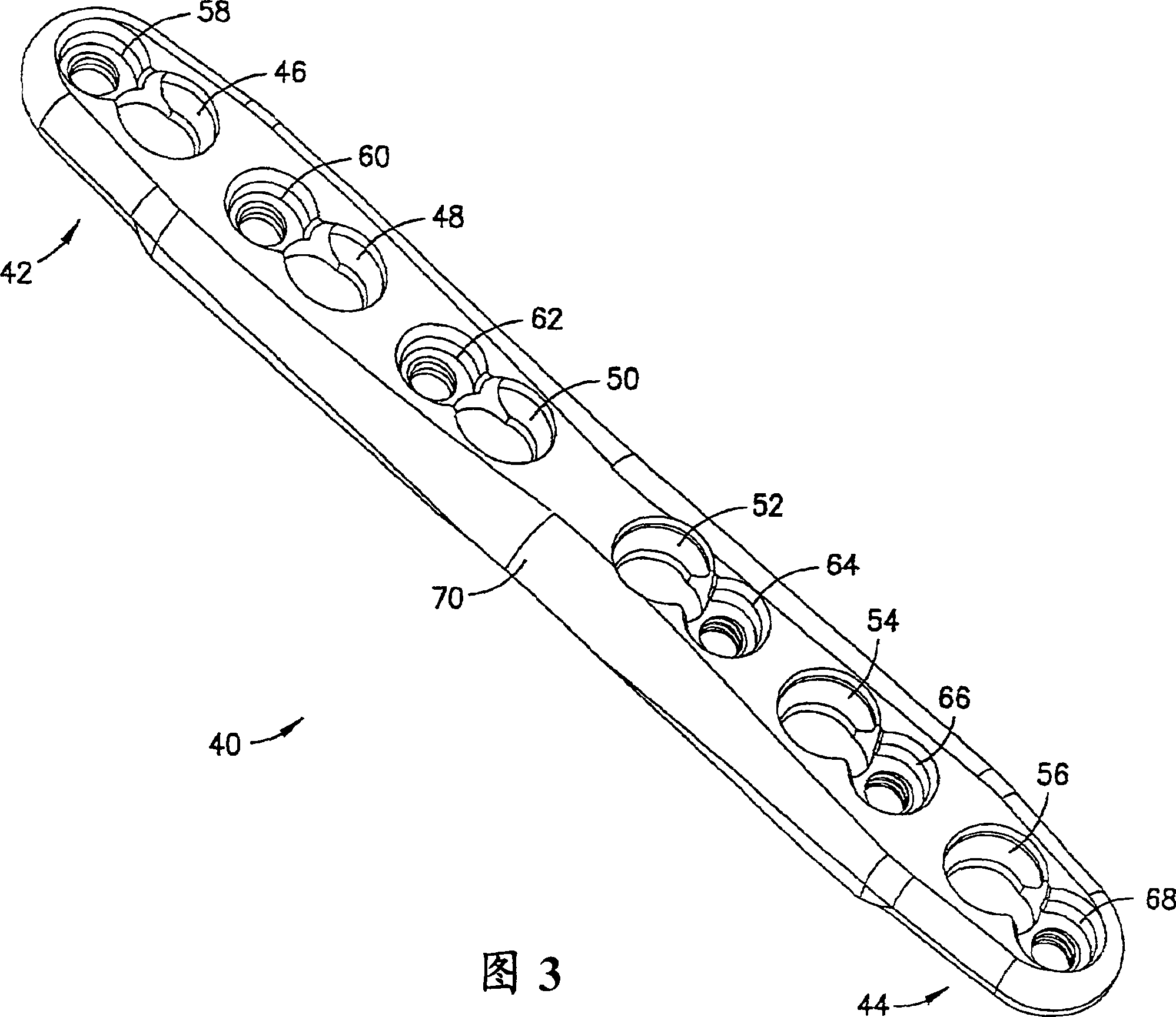 Modular fracture fixation plate system