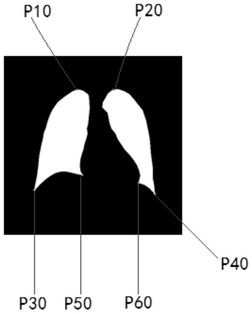 A Method for Calculating Cardiothoracic Ratio in Medical Images